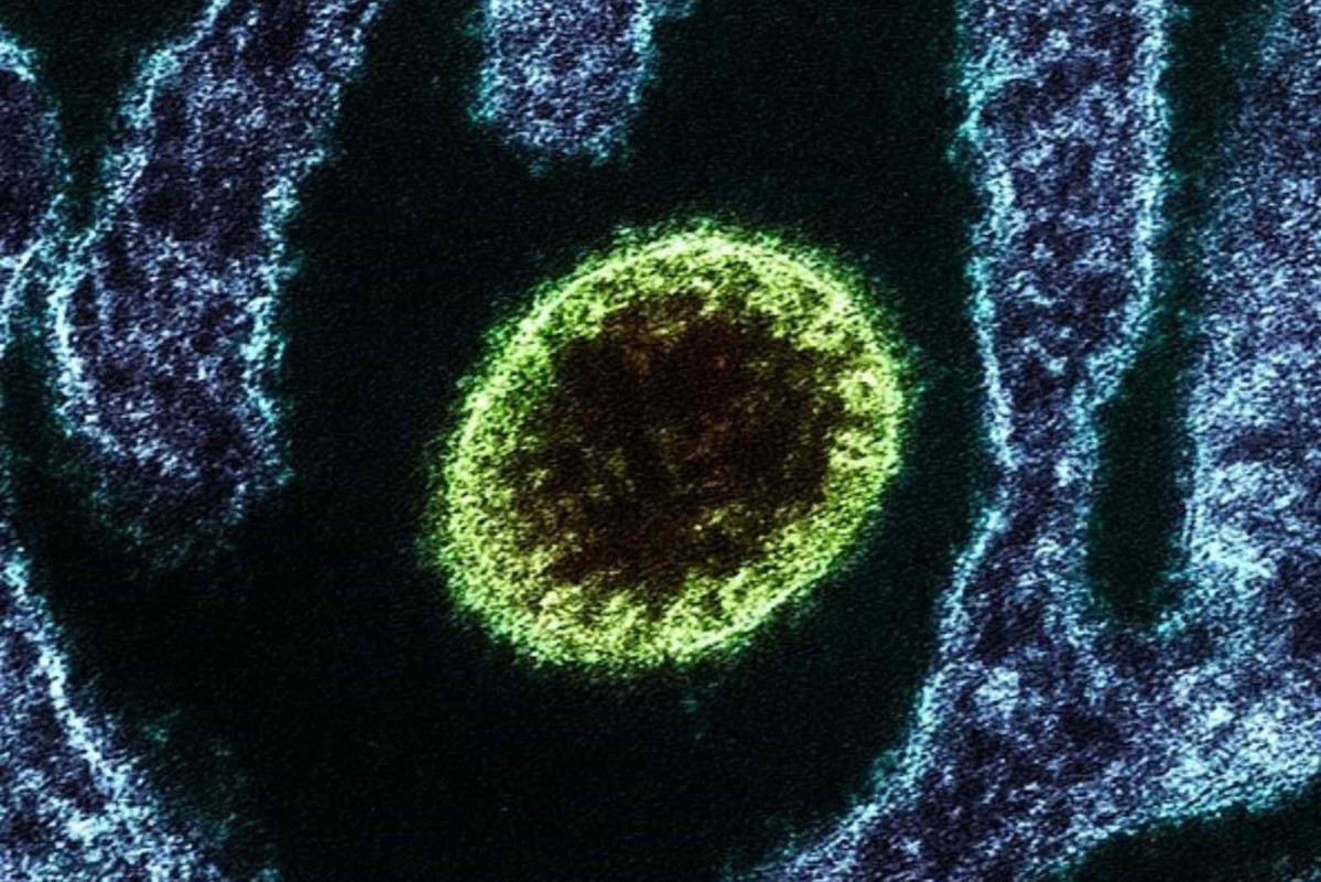 Virus Nipah