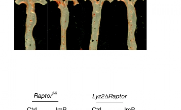 Descubren un metabolito intestinal clave en el origen de la aterosclerosis