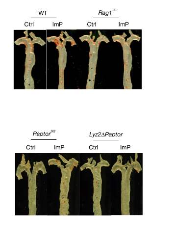 Descubren un metabolito intestinal clave en el origen de la aterosclerosis