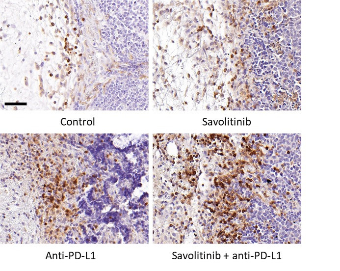 Imatge estudi Cell Reports Medicine