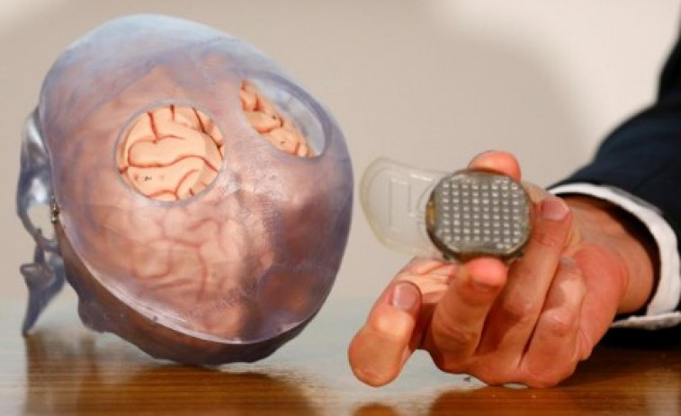 Un hito de Stanford con dos caras: el implante cerebral que nos acerca a la telepatía