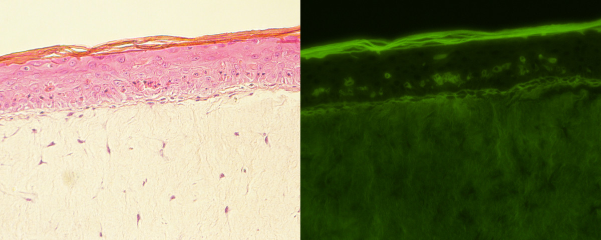 Eurecat Phenolexa imatges microscopi