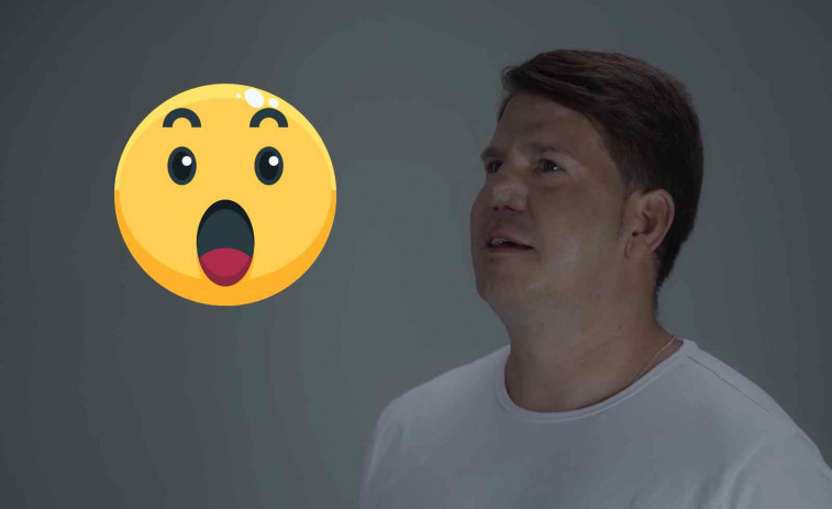 Lucas, de Andy y Lucas, explica su peor experiencia con la nariz: 