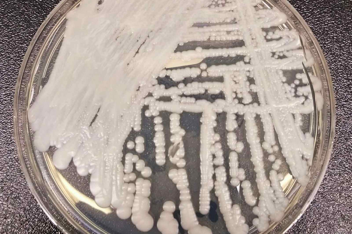 Una cepa de Candida auris cultivada en una placa de Petri en un laboratorio de los CDC.   Wikipedia