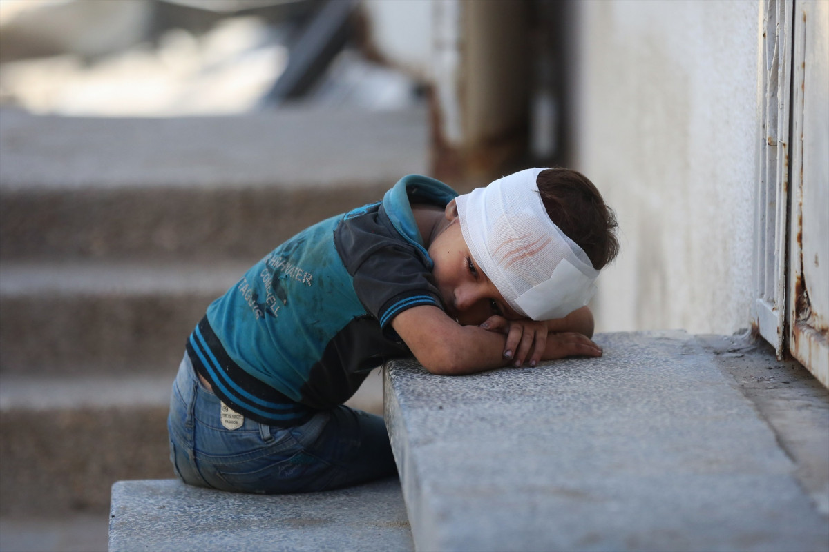 EuropaPress 6958480 16 september 2025 palestinian territories gaza an injured palestinian boy (1)