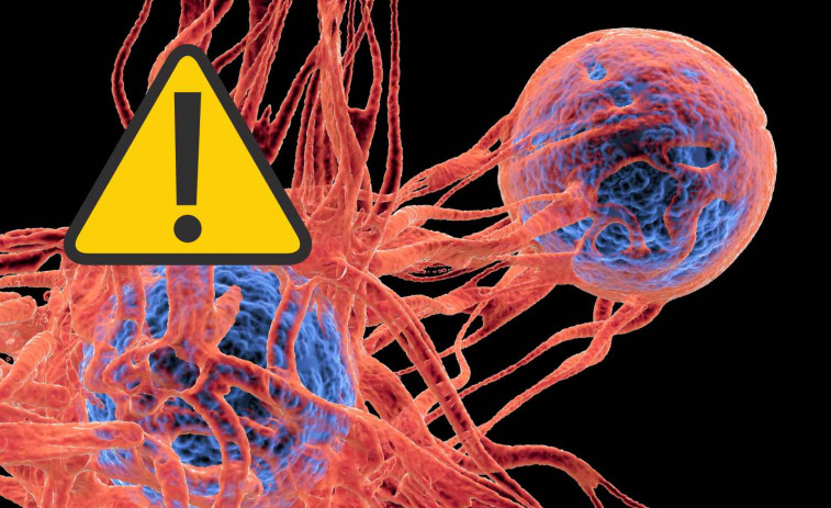 Los casos de cáncer colorrectal se están disparando entre los jóvenes: ¿Qué está ocurriendo?