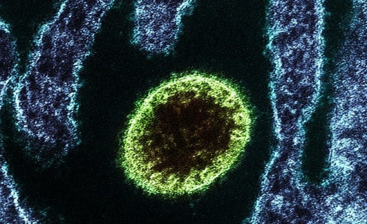 El virus Nipah: vuelven los controles en aeropuertos