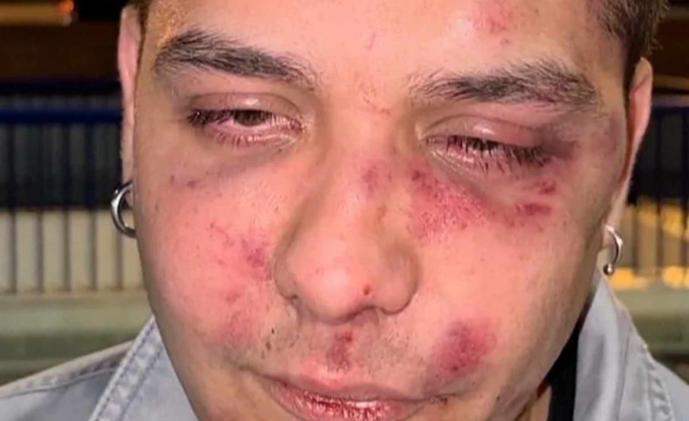 VÍDEO | Un joven denuncia que ha recibido una brutal paliza en Málaga: “Tú eres antifascista, verdad?”