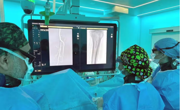 El Hospital Trueta de Girona lidera un avance médico en Catalunya para evitar la amputación de extremidades