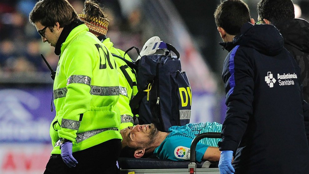 Lesion busquets