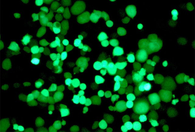 Infecci 1