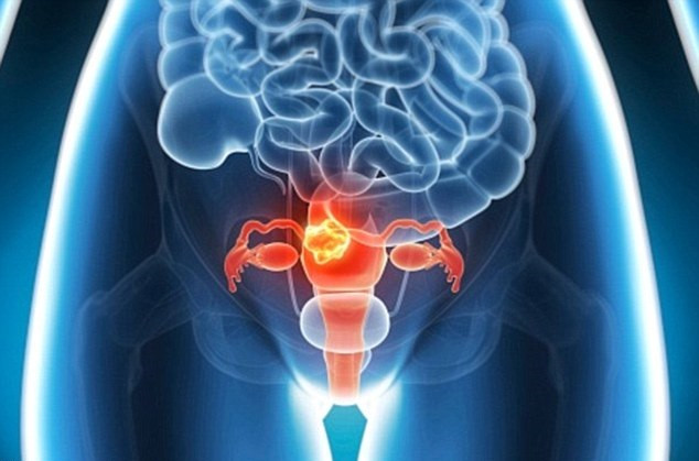 Los casos de cáncer de cuello de útero caen un 70%