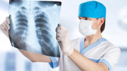 Tuberculosis2