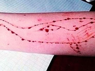 ​Una menor ha sido ingresada en una unidad psiquiátrica por participar en el juego la ‘Ballena Azul’